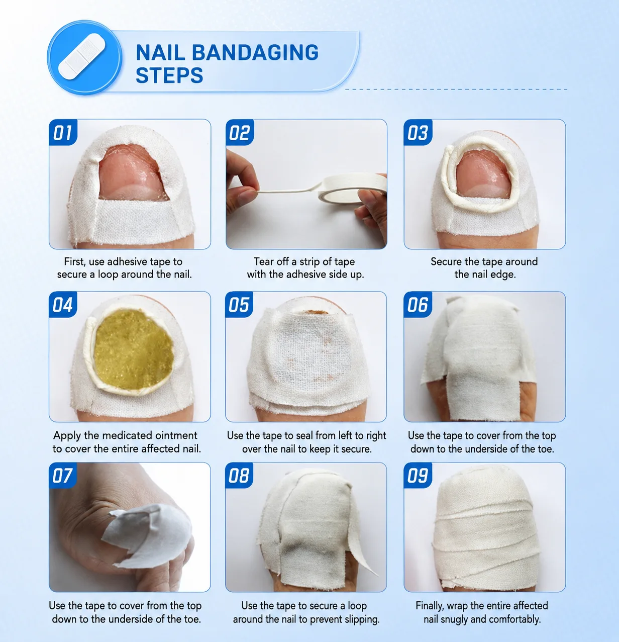 Nail bandaging steps: detailed 9-step wrapping guide