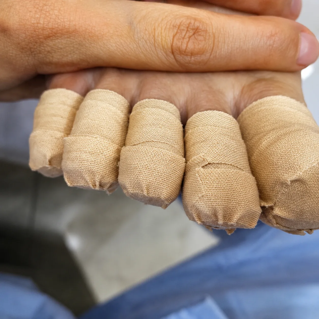 Multiple nails wrapped with bandages after herbal cream application