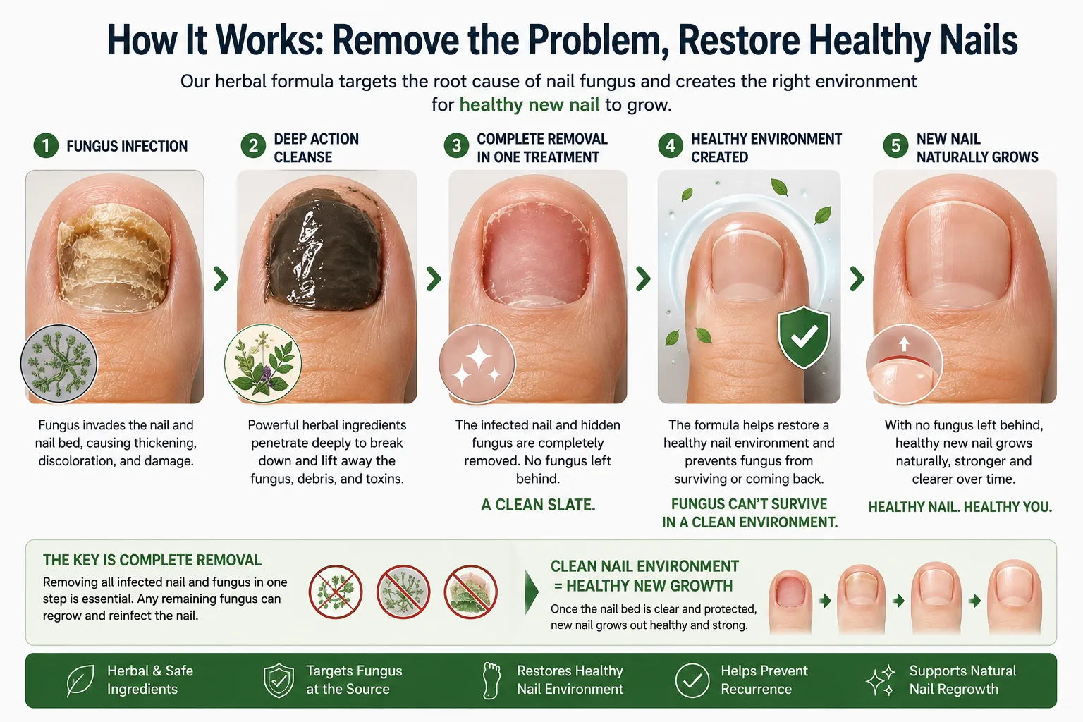 How herbal nail cream works: 5-step process from infection to healthy nail