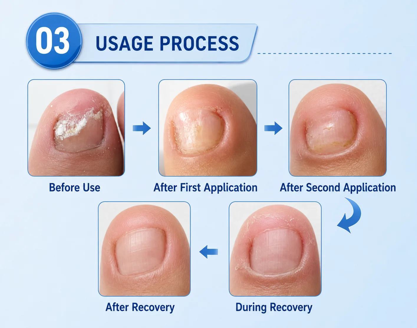 Usage process: step-by-step photos showing nail before and after care cycles